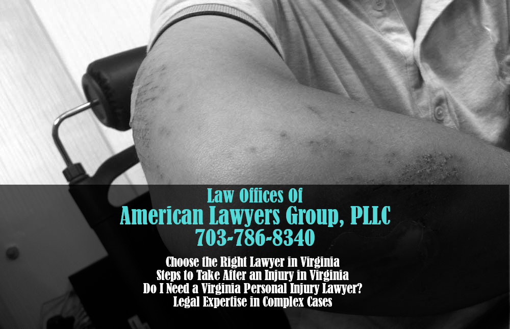 Personal Injury Lawyers in Virginia